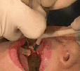 gif-de-dent-sagesse-risitas-extraction-dentiste
