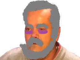 cernes risitas fatigue vieux