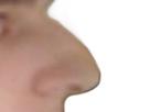 laid-zoom-regard-ultra-phasmort-moche-nez-profil