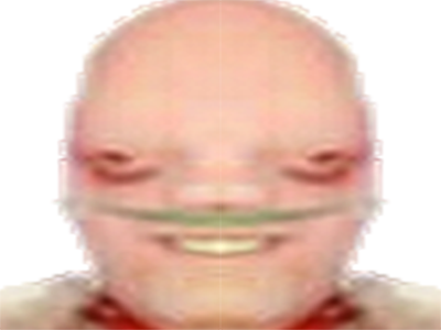 malade cancer risitas