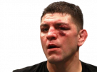 diaz casse nick gueule ufc