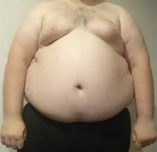 graisse risitas gros obese