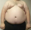 graisse-risitas-gros-obese