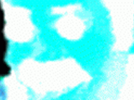 alerte risitas eclair douleur