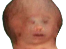 wtf-siamois-bebe-blase-quoi-difforme-gange-inde-onizuka-hein-other-foetus