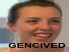 gencive-other-elo-gencived