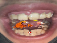 zeroavenirs dents sales