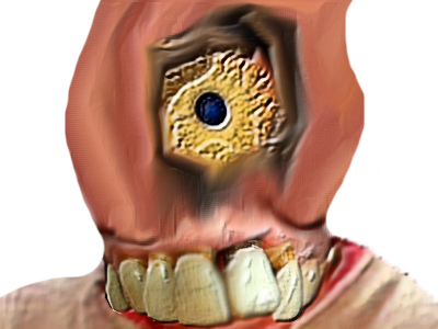 risitas issou laid immondice chicots moche difforme