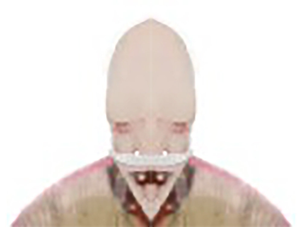 risitas malade miroir cancer