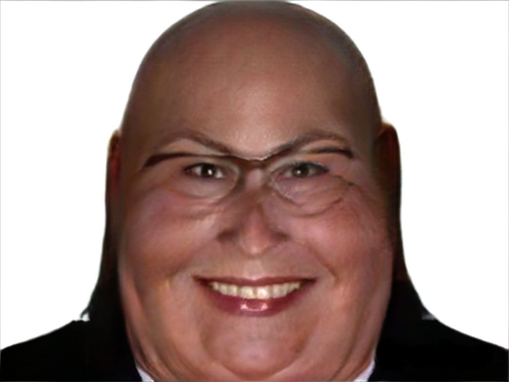 gronalda ronaldo chauve