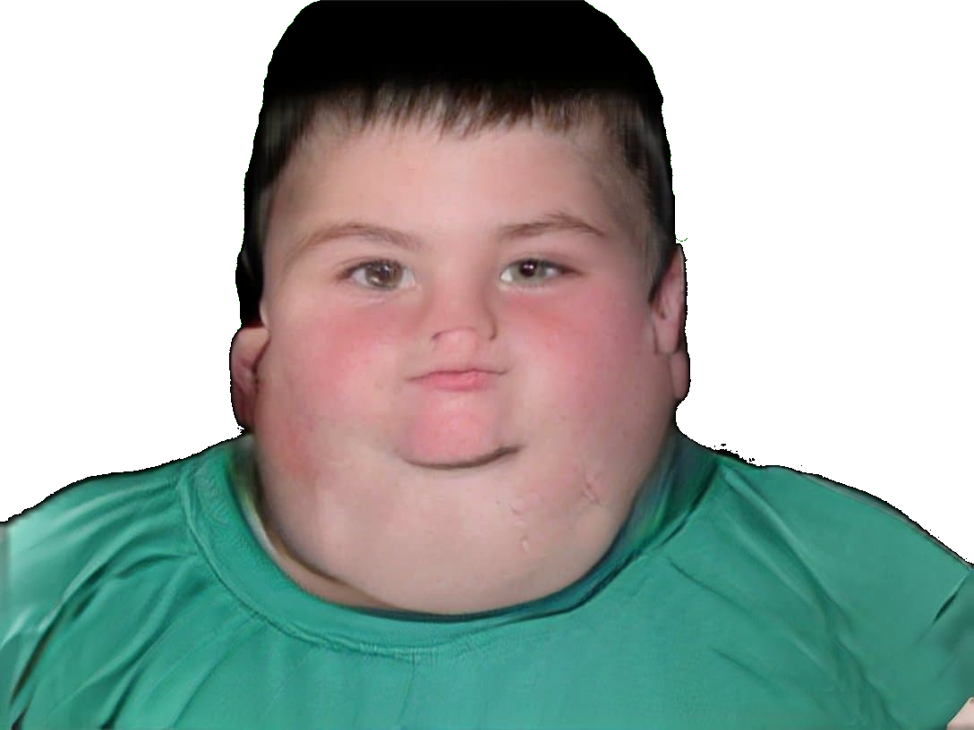 obese immondice enfant ignoble jvc creepy moche difforme magalie