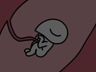 avortement-other-cormoche-foetus-paz-embryon