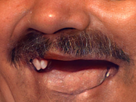 moustache-nez-bouche-zoom-rire-risitas-dent