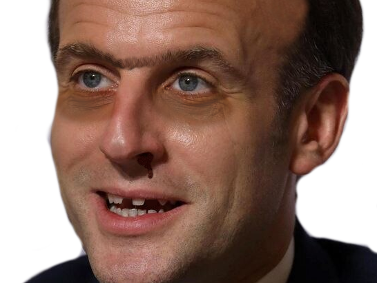 macron politic calvitie cernes moche