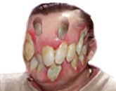 de poule viol risitas