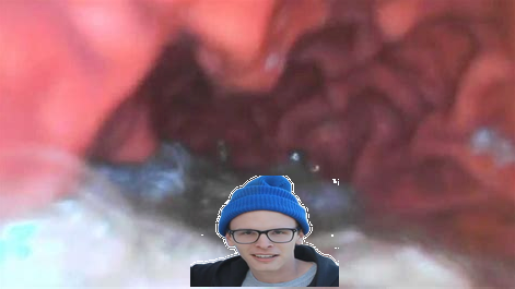 magalie celestin vore estomac