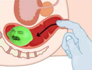 holly-risitas-rectum-insersion-vert-citron