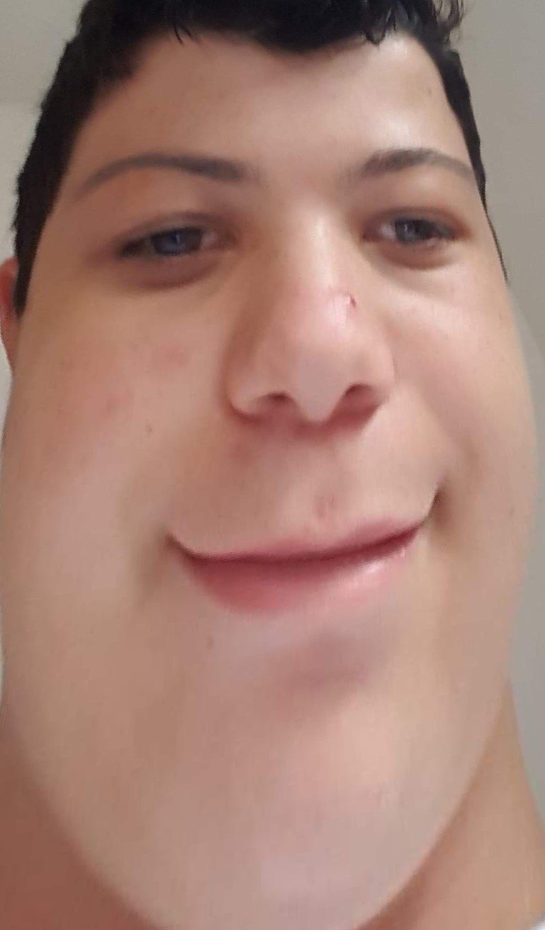 nolwen le ouinn enorme menton