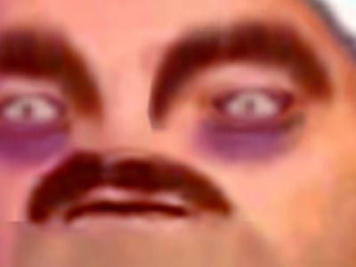 risitas zoom cernes fatigue sommeil insomnie insomniaque tinnova 2sucresreup 2sreup pasdemoi