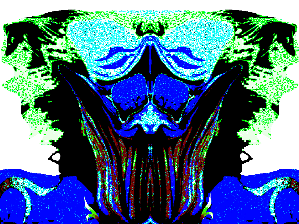 patrick balkany escroc prison arnaque vol voleur carabistouille tison lunettes bleues batman demon joker sorciere