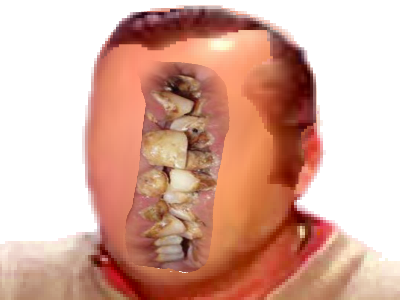 peur kheyissoussois deforme issou creepy risitas