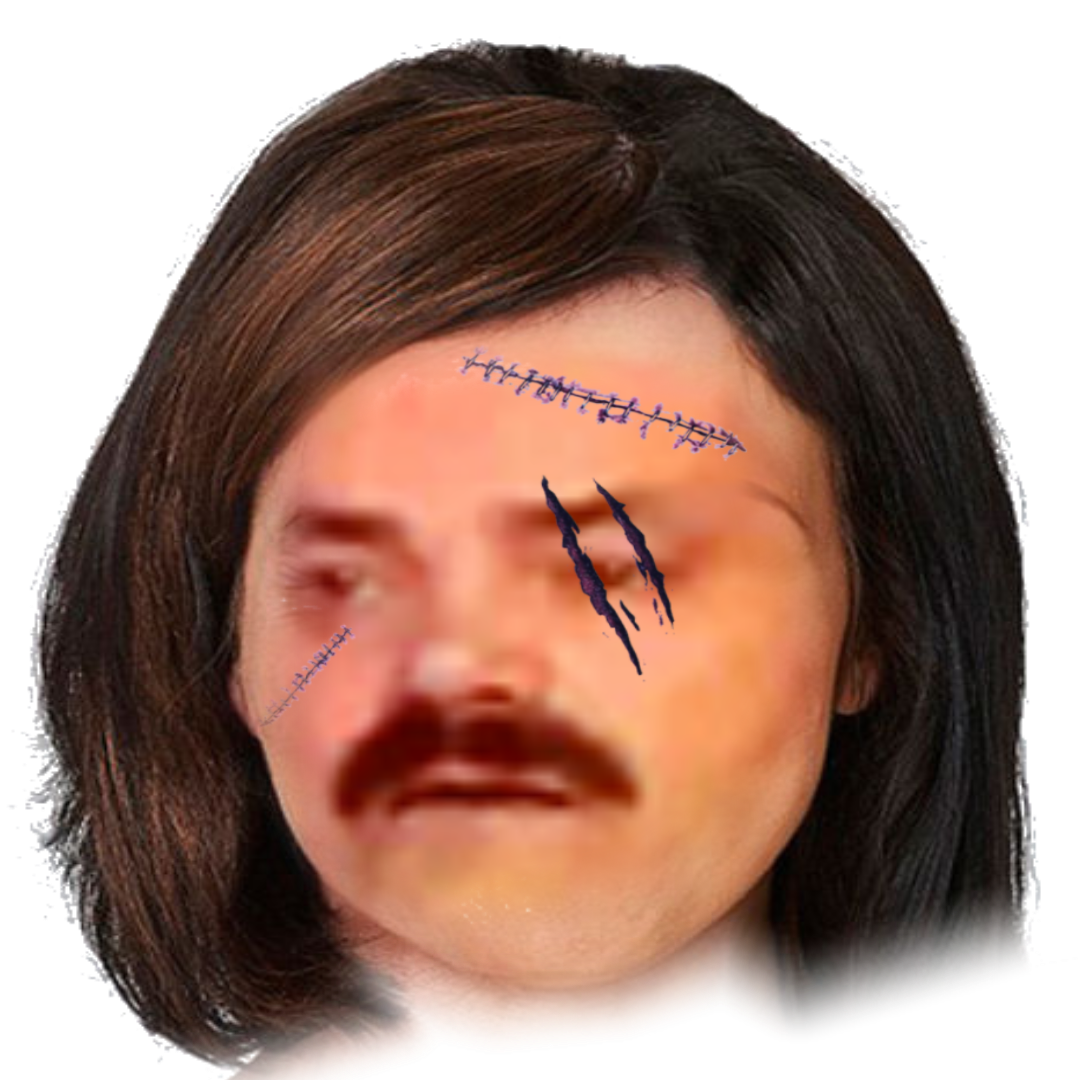 fille risigirl balafree risitas issougirl girl balafre