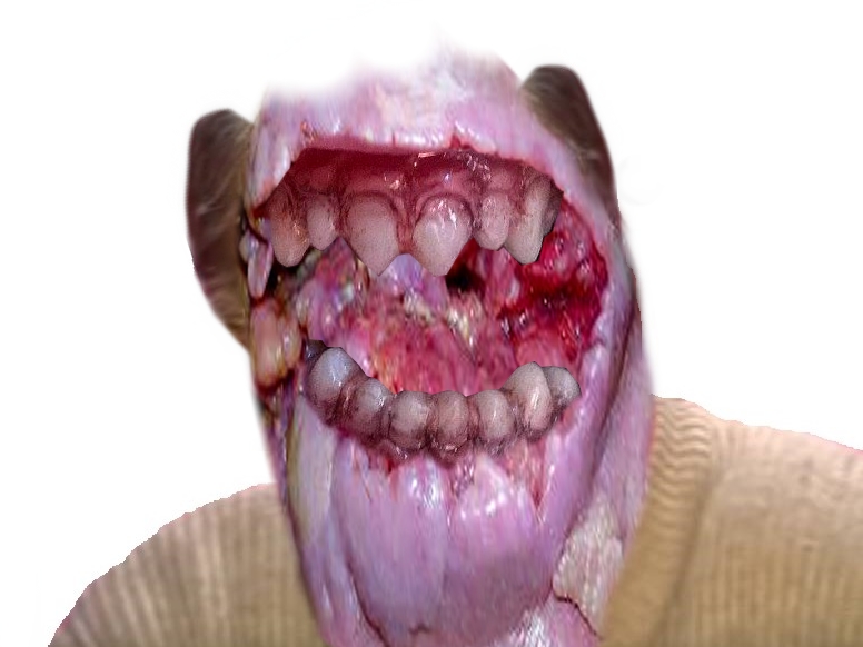 creepy monstre issou risitas