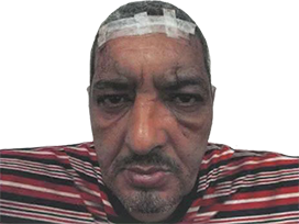 broula criminel prisonnier evade fait peur arabe patibulaire cernes pansement bout de sa vie seum