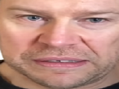 gundill michael malaise