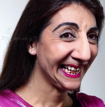 linakhan moche dentspourries grospif deguelasse