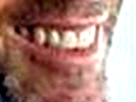 zidane-dent-sourire