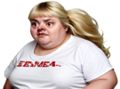femme-grosse-moche-deforme-difforme-serieux-peau-genou-obese-magalax