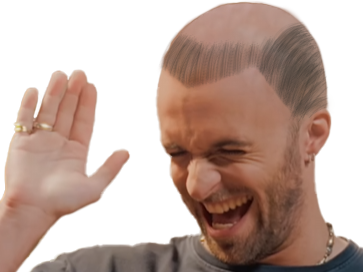 squeezie calvitie medieval peigne tonsure moine