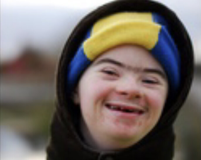 trisomie trisomique 21 triso handicape