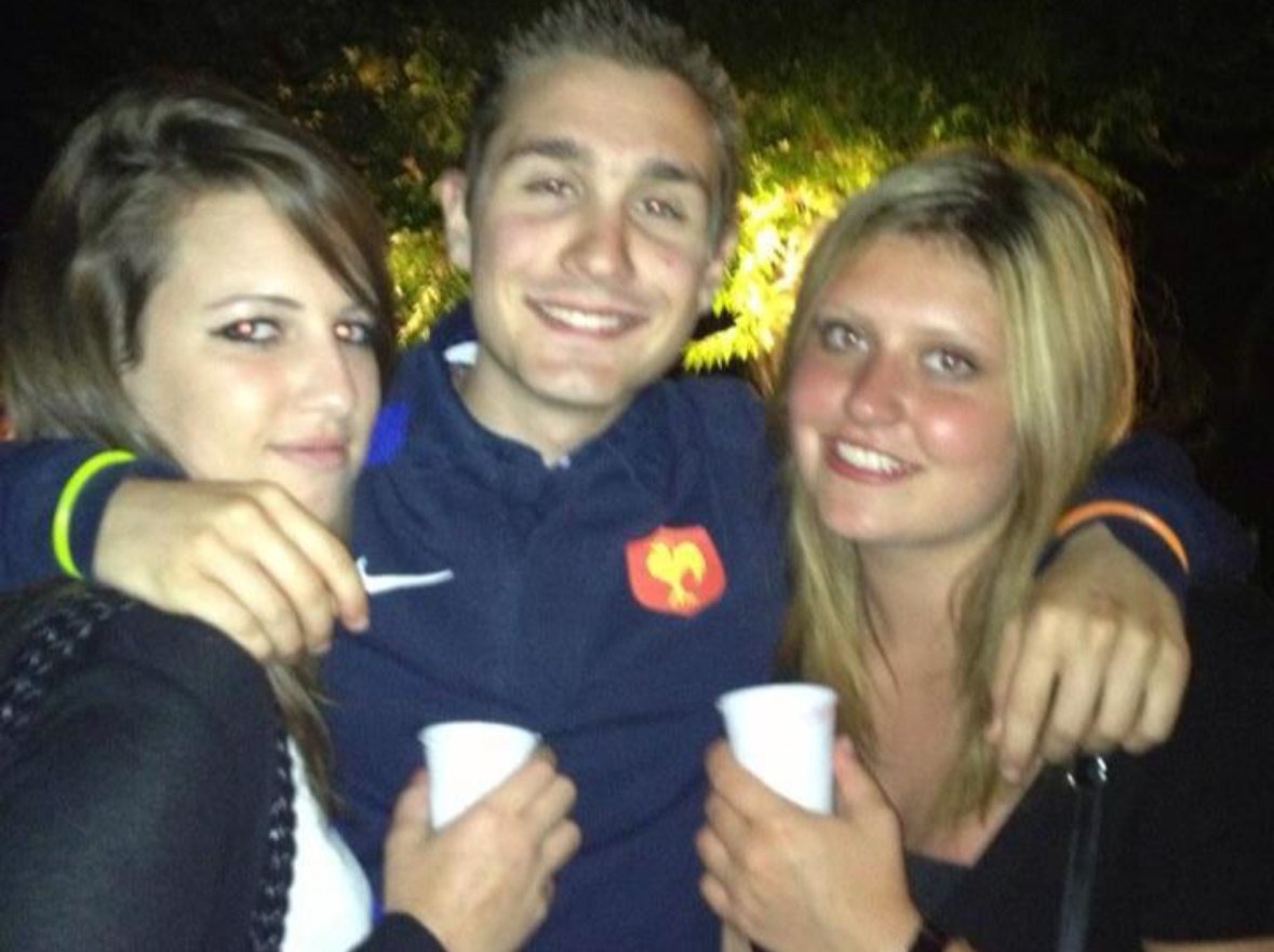 chad 0tout pea blonde pecho