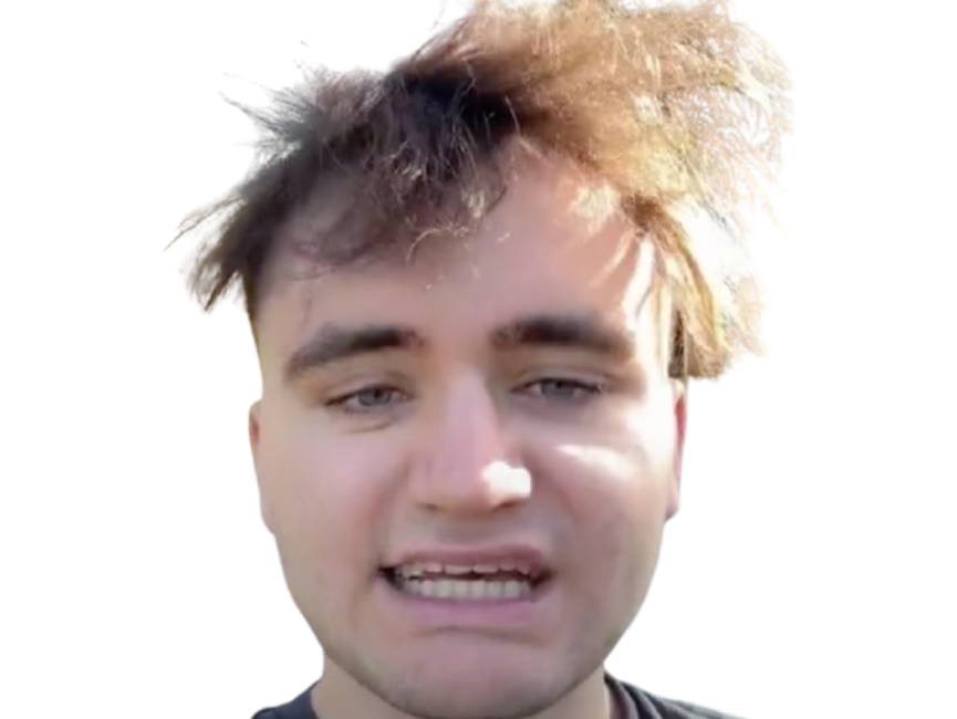 neo swan youtube brise calvitie calvasse yummy ca suffit