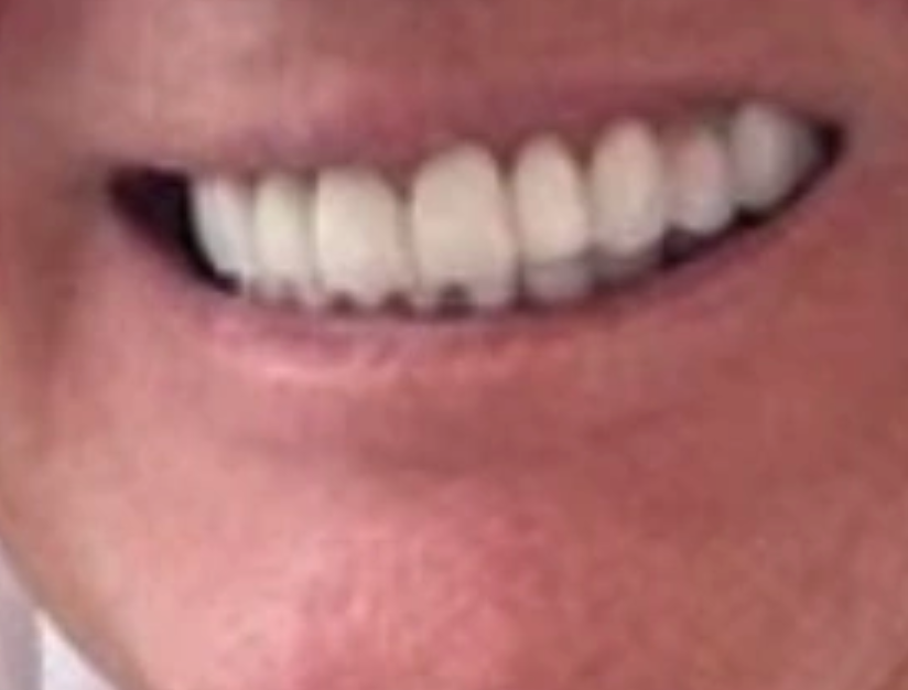 trump sourire dents troll donald usa politique eipstein kamala election et toi biden