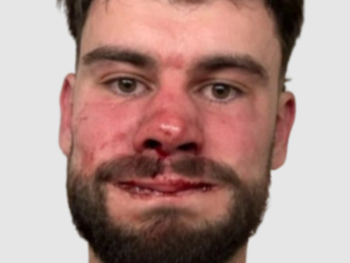 le bouseuh brise nez tete de con