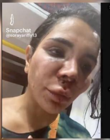 influenceuse soraya agressee snap insta rs arabe qlf femme meuf fille tchoin