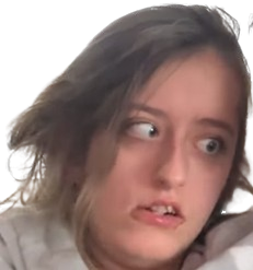 louise triso handicape regard yeux strabisme moche gogol zinzin femme