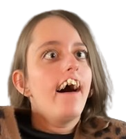 louise triso handicape regard yeux strabisme moche gogol zinzin femme