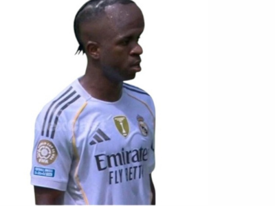 vinicius jr junior real madrid gros front grosse tete macrocephalie oedeme nul