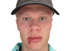 erling-haaland-hypnose-casquette-blessure-flippant-terreur-selfie-grosse-tete-bobo-blesse-regard-croute