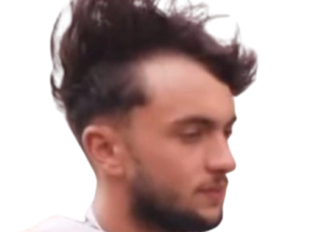 inoxtag inox michou calvitie calv norwood chauve