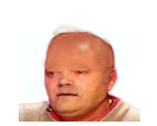 emilien chauve sans risitas poil