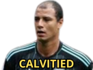 marouane-chamakh-calvitie-calvitied
