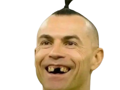 ronaldo penaldo finito surcotax penalty moche chirurgie kangourou metrosexuel sanspere foot football cr7 botox botoxe