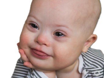 bebe trisomique continu nous tecoutons mepris meprisant