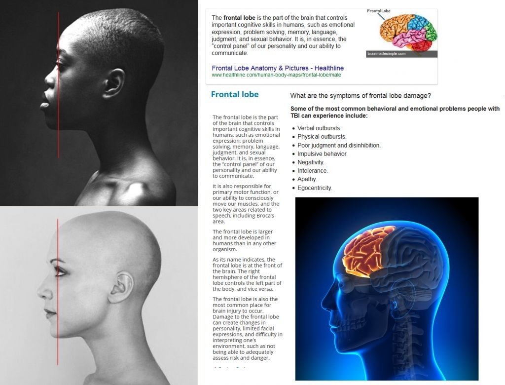 lobe frontal explained difference noir juif blanc realite redpill