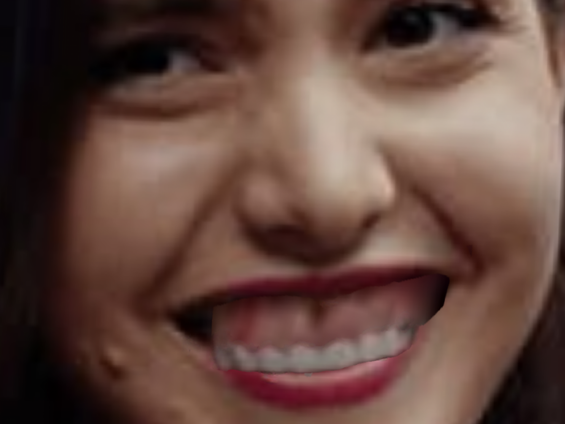 alexandra botez joueuse echecs echec mat soeur andrea moche sourire gencive de saumon mega zoom